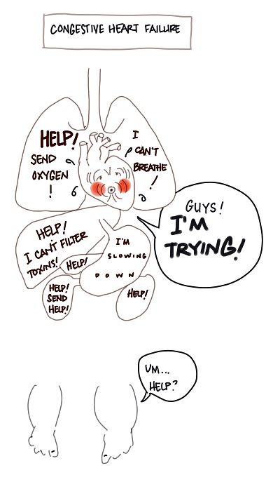 diagram of organs needing oxygen, while the heart says it's doing as much as it can: Congestive heart failure